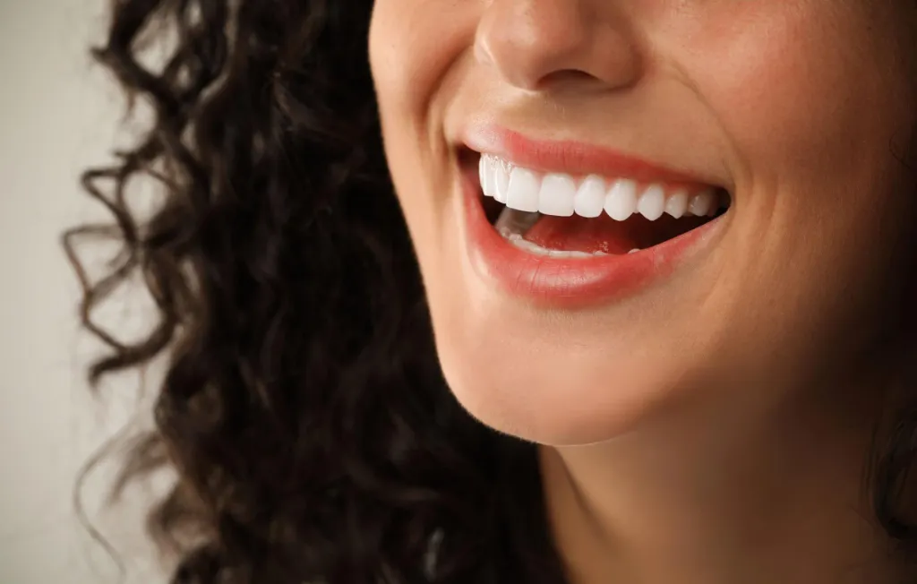 Dental Veneers